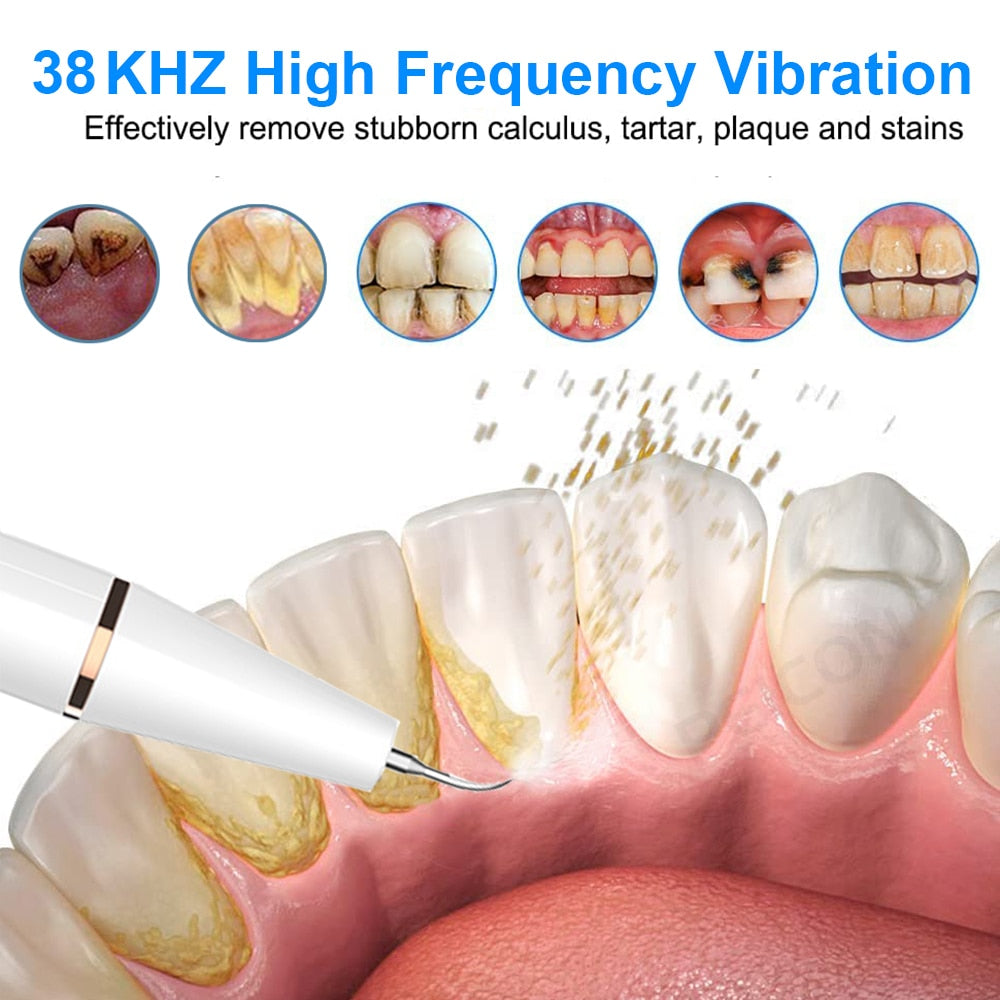 Ultrasonic Dental Scaler For Teeth Tartar Stain Tooth Calculus Remover Electric Sonic Teeth Plaque Cleaner Dental Stone Removal